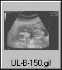 UL-B-150.gif